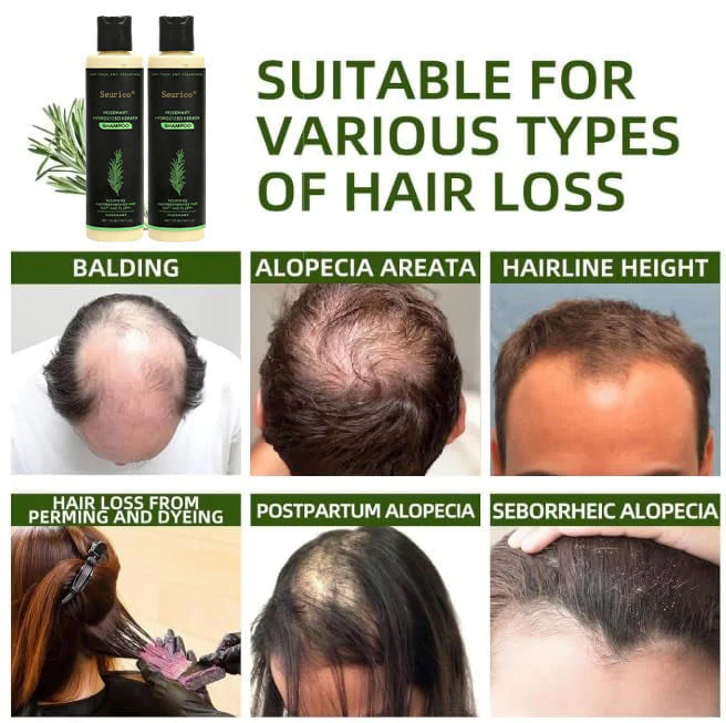 Organic Rosemary Hair Growth Shampoo